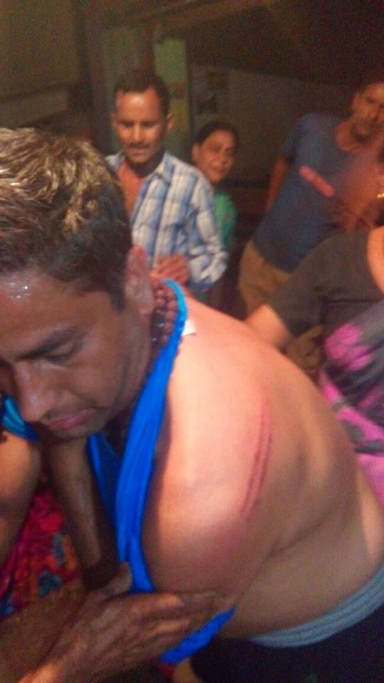 Sameer Raturi beaten by police